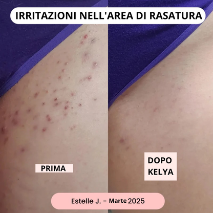 Rasoio Kelya®