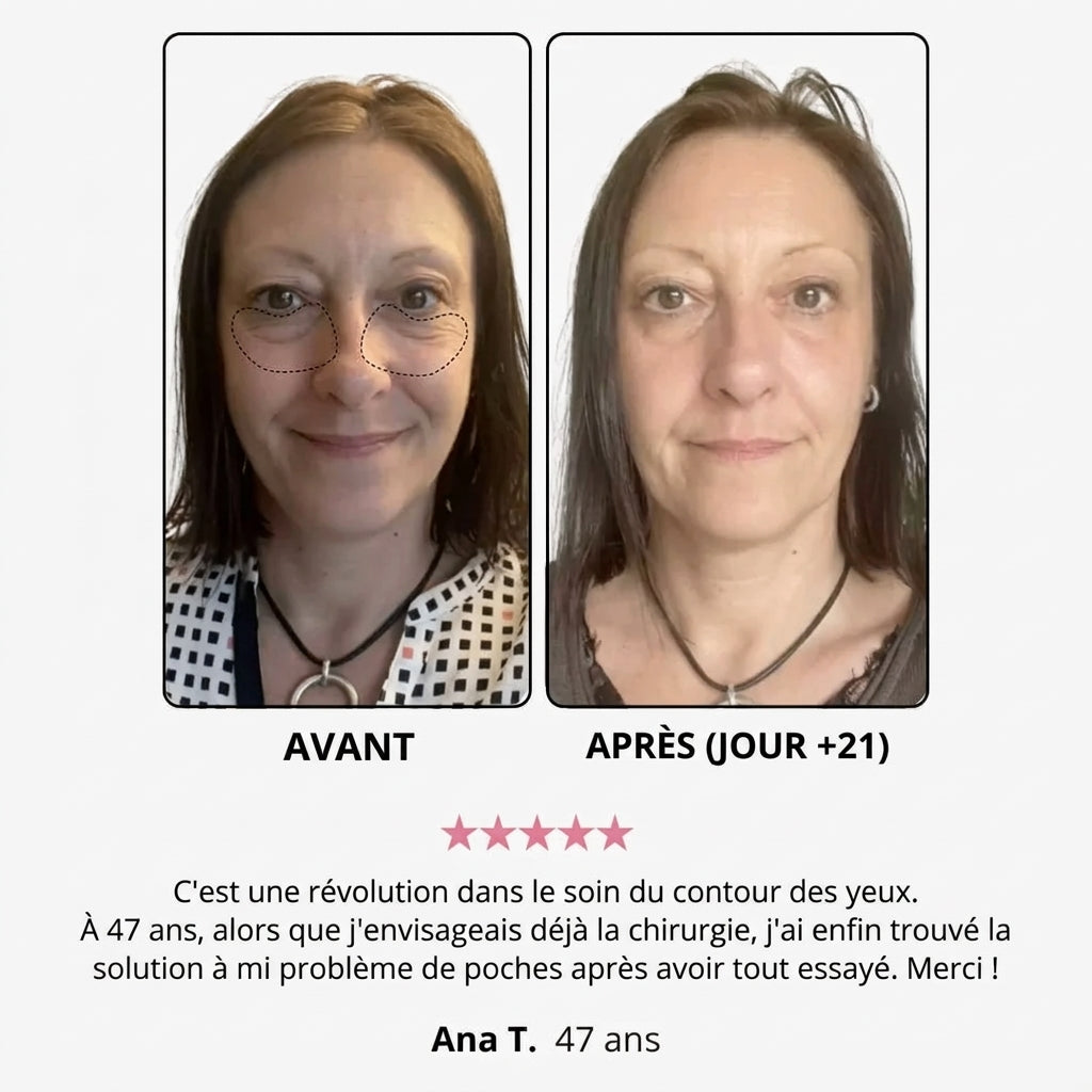 Crème à la lumière rouge Kelya® pour le contour des yeux, en tube blanc avec applicateur, visible en gros plan.